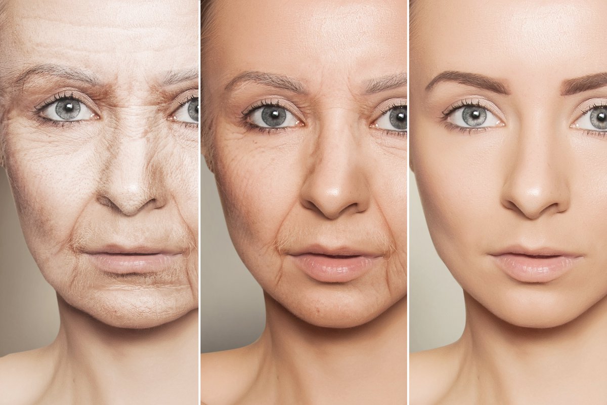 RSMedSpa's tweet image. Are you a good candidate for #Botox for #UnderEye #Wrinkles? Give us a call renosparksmedspa.com/video-gallery/…