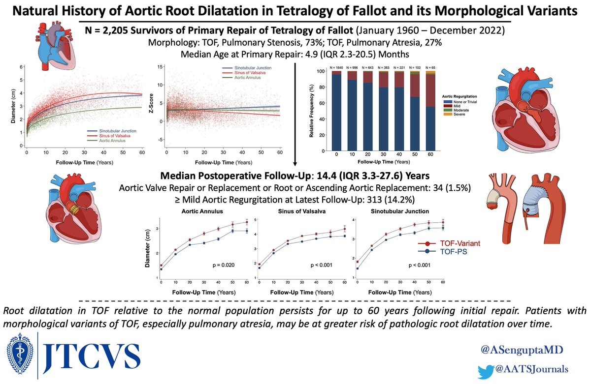 AATS Journals (@aatsjournals) on Twitter photo #AATS2023 Natural History of Aortic Root Dilatation and Pathologic Aortic Regurgitation in Tetralogy of Fallot and its Morphological Variants. Read the #JTCVS article by <a href="/ASenguptaMD/">Aditya Sengupta, MD, MPH</a>, Nathan et al: doi.org/10.1016/j.jtcv…
#CHD #TetralogyofFallot <a href="/AATSHQ/">AATS</a> <a href="/tssmn/">CTSurgSocMedNetwork</a> <a href="/BostonChildrens/">Boston Children's</a> #AATS2023 Natural History of Aortic Root Dilatation and Pathologic Aortic Regurgitation in Tetralogy of Fallot and its Morphological Variants. Read the #JTCVS article by <a href="/ASenguptaMD/">Aditya Sengupta, MD, MPH</a>, Nathan et al: doi.org/10.1016/j.jtcv…
#CHD #TetralogyofFallot <a href="/AATSHQ/">AATS</a> <a href="/tssmn/">CTSurgSocMedNetwork</a> <a href="/BostonChildrens/">Boston Children's</a>