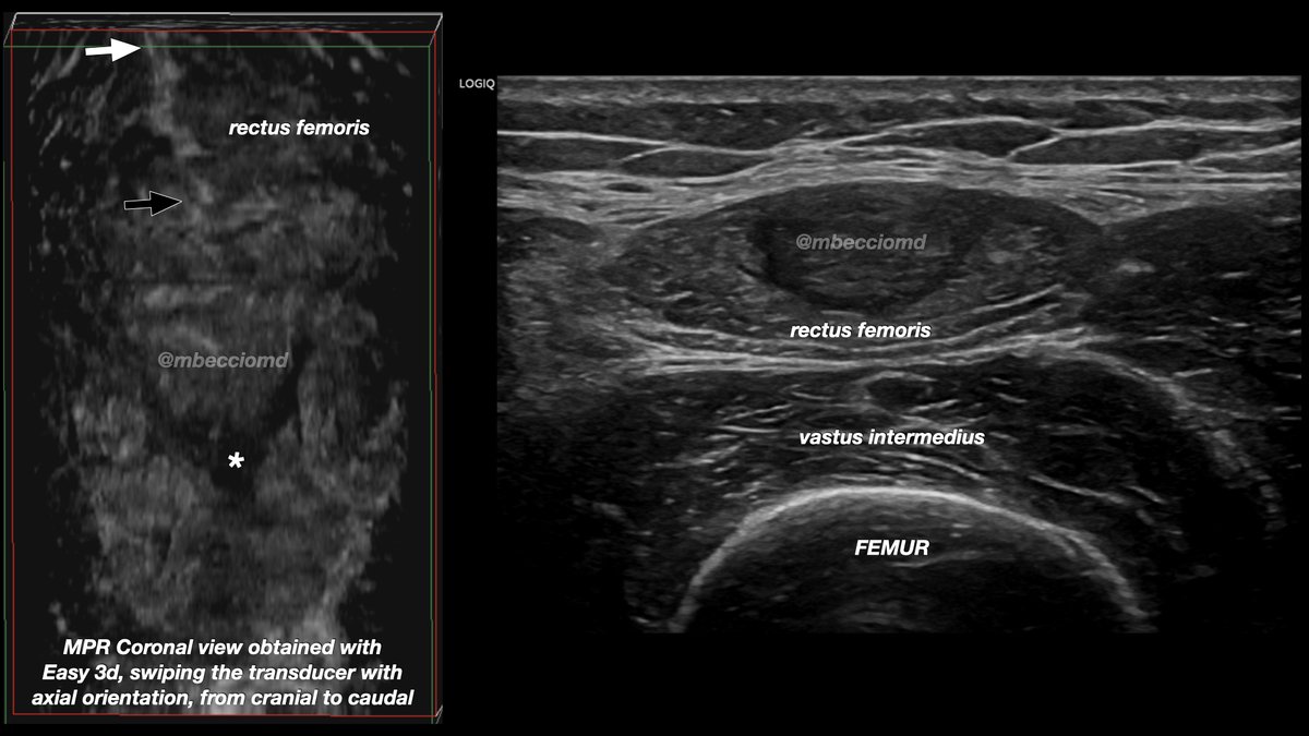 Ultrasound Imaging tweet media