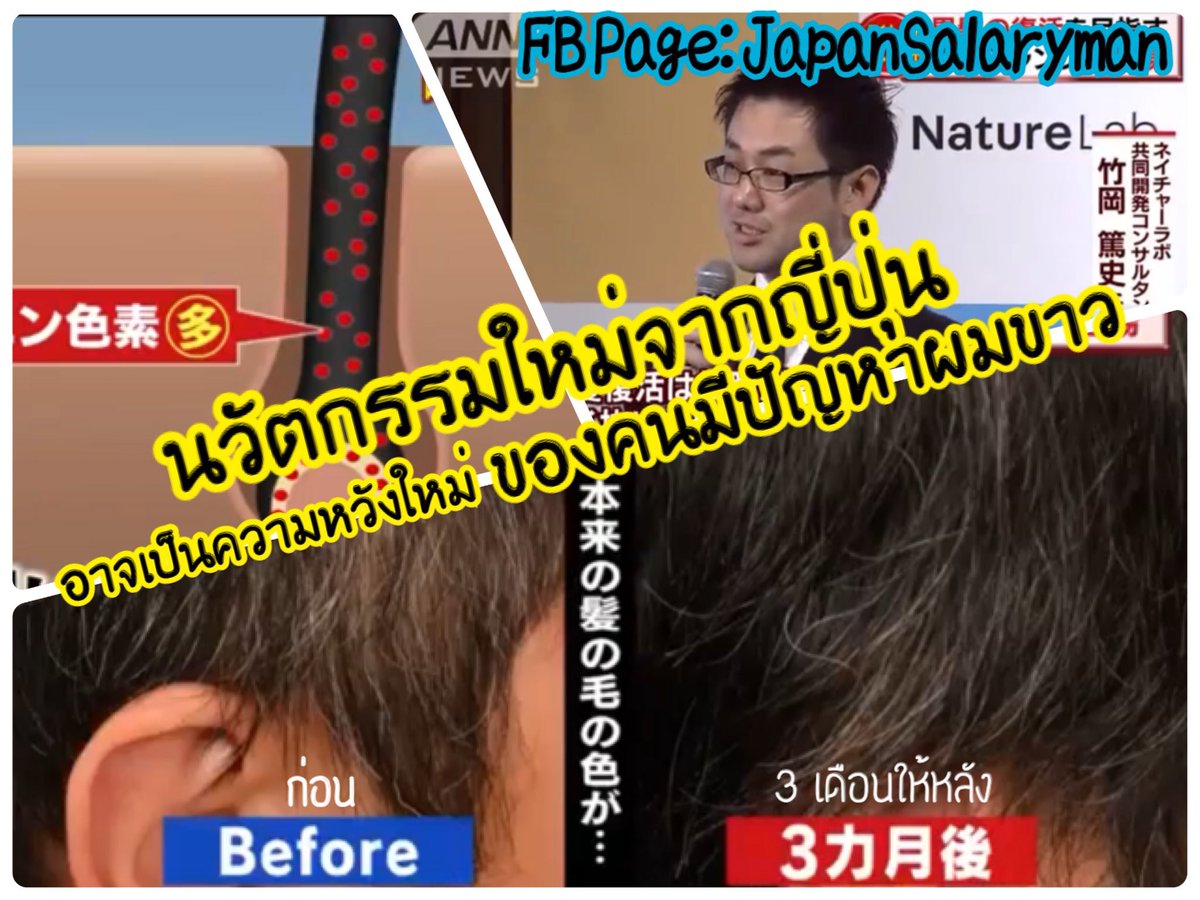 JapanSalaryboom's tweet photo. ที่ญี่ปุ่นขยันทำนวัตกรรมใหม่ๆ ออกมาแก้ไขปัญหาให้ผู้คนมาก โดยเฉพาะ “ปัญหาผมขาว” ที่คนญี่ปุ่นกังวลกันเยอะตอนนี้มีนวัตกรรม Black Reverse ที่ใส่อยู่ในยาสระผม สามารถช่วยฟื้นฟูผมขาว ให้กลับมาดำอีกครั้ง ⚪️>⚫️
นวั���กรรมนี้น่าสนใจอย่างไร ใครกังวลปัญหาผมหงอกผมขาว ไปดูกันครับ!

Cr: ANN News https://t.co/uW58XiyLZG
