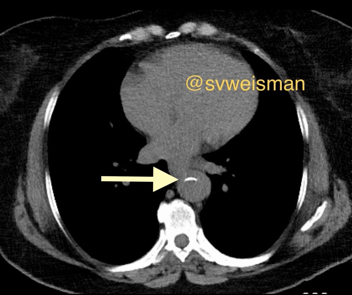 Stacey Verzosa Weisman, MD tweet media