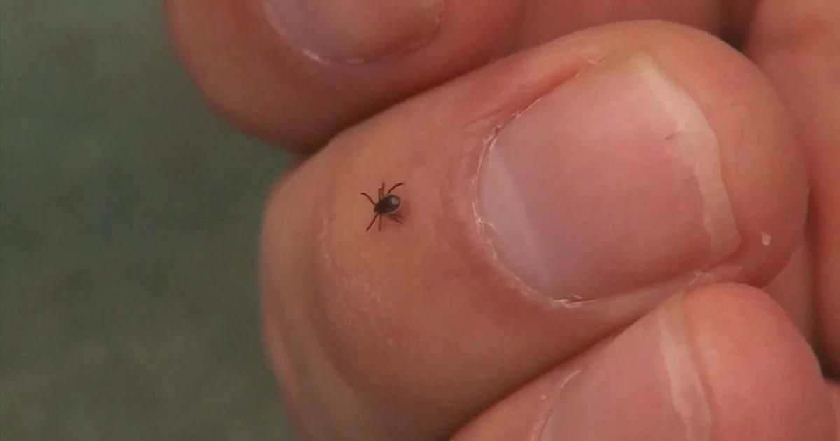 RT @WCCO: Warm weather brings out ticks in Minnesota https://t.co/RHShN2hrmG https://t.co/C89V0ayEIT