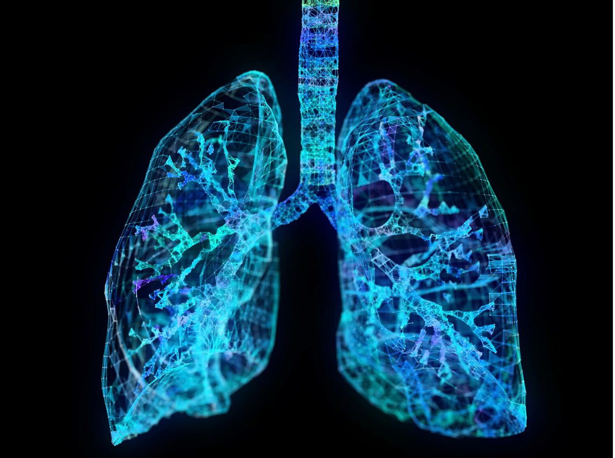 HealthInnovOx's tweet image. Do you work in #respiratory care? Join our free workshop in London on 4 July to find out how innovations and pathway improvements are #TransformingAsthma care. eventbrite.co.uk/e/the-future-o… #AHSNs
@AHSNNetwork @AACinnovation
