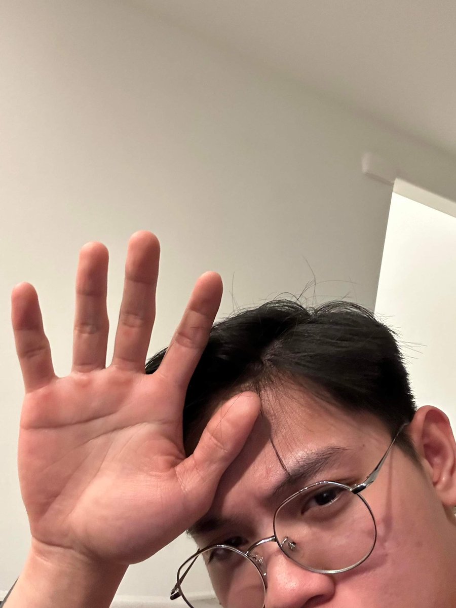 Hirap daw ng “LDR” Kinakalyo na daw siya🥲