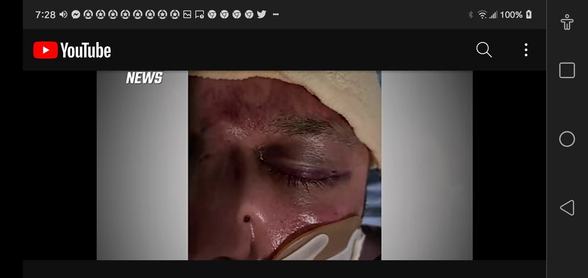 NutsORguts's tweet photo. @BradHellgoblin @DrZee1001 @ABDanielleSmith AB officers 2:57pm told release Dan Robinson- never in jail&amp; no criminal record. 11:10pm broken nose&amp; ribs- witnesses to murder https://t.co/v8ssD8ANKb
Sept7/21 Autopsy a Lie
https://t.co/Vi9LVQr8L3 7days closed- Complaint re: Actions of 7d &amp; lie÷Zero answers https://t.co/vRVbkPpiN9
