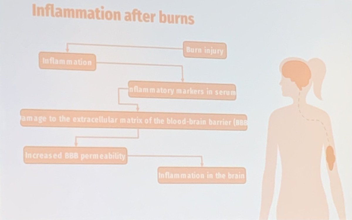 Dr Sarah Beecroft (@sarah_beecroft) on Twitter photo Amazing work from Amira Allahham showing burn victims have poorer mental health outcomes 5-18 years after the burn. This appears at least partly mediated through inflammation. Fascinating! <a href="/science_swan/">Science on the Swan</a> #SOTS2023 <a href="/UWAresearch/">UWA Research</a> Amazing work from Amira Allahham showing burn victims have poorer mental health outcomes 5-18 years after the burn. This appears at least partly mediated through inflammation. Fascinating! <a href="/science_swan/">Science on the Swan</a> #SOTS2023 <a href="/UWAresearch/">UWA Research</a>