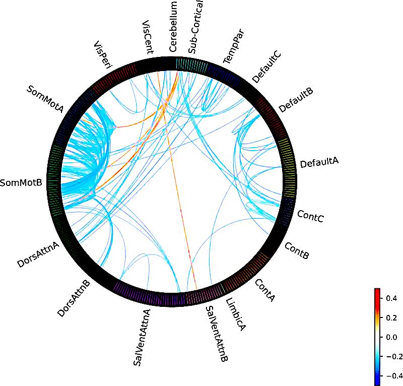 Paul Thompson (@ptenigma) on Twitter photo LARGEST-EVER #OCD BRAIN IMAGING study pools 1,024 OCD patients' functional MRI scans (across 24 labs!!); worst connectivity deficits in sensorimotor brain networks (Cohen’s d: -0.27)+psychotropic drug effects; kudos➡️Willem Bruin, Guido v. Wingen: 🧠⚕️➡️❤️‍🩹 nature.com/articles/s4138… LARGEST-EVER #OCD BRAIN IMAGING study pools 1,024 OCD patients' functional MRI scans (across 24 labs!!); worst connectivity deficits in sensorimotor brain networks (Cohen’s d: -0.27)+psychotropic drug effects; kudos➡️Willem Bruin, Guido v. Wingen: 🧠⚕️➡️❤️‍🩹 nature.com/articles/s4138…