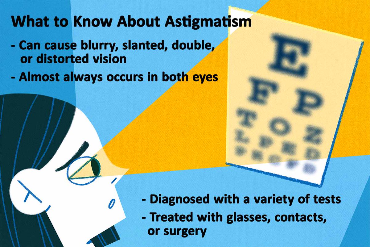 Astigmatism is a common and generally treatable imperfection in the curvature of the eye that causes blurred distance and near vision. Astigmatism occurs when either the front surface of the cornea or the lens inside the eye has mismatched curves. 
#astigmatism #eyediseases