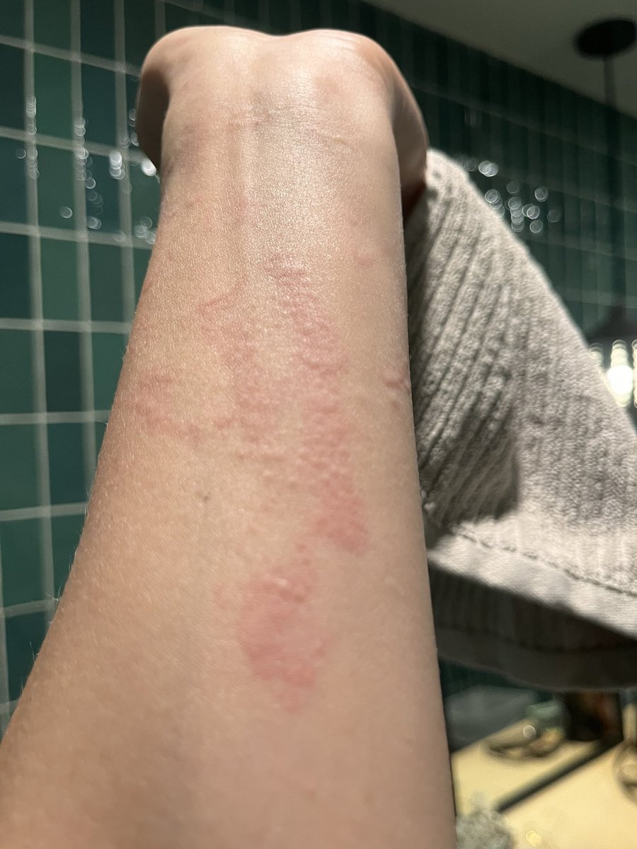 Sabrina Nichole on Twitter "I’m not joking when I say I’m allergic, this shits sooooo annoying