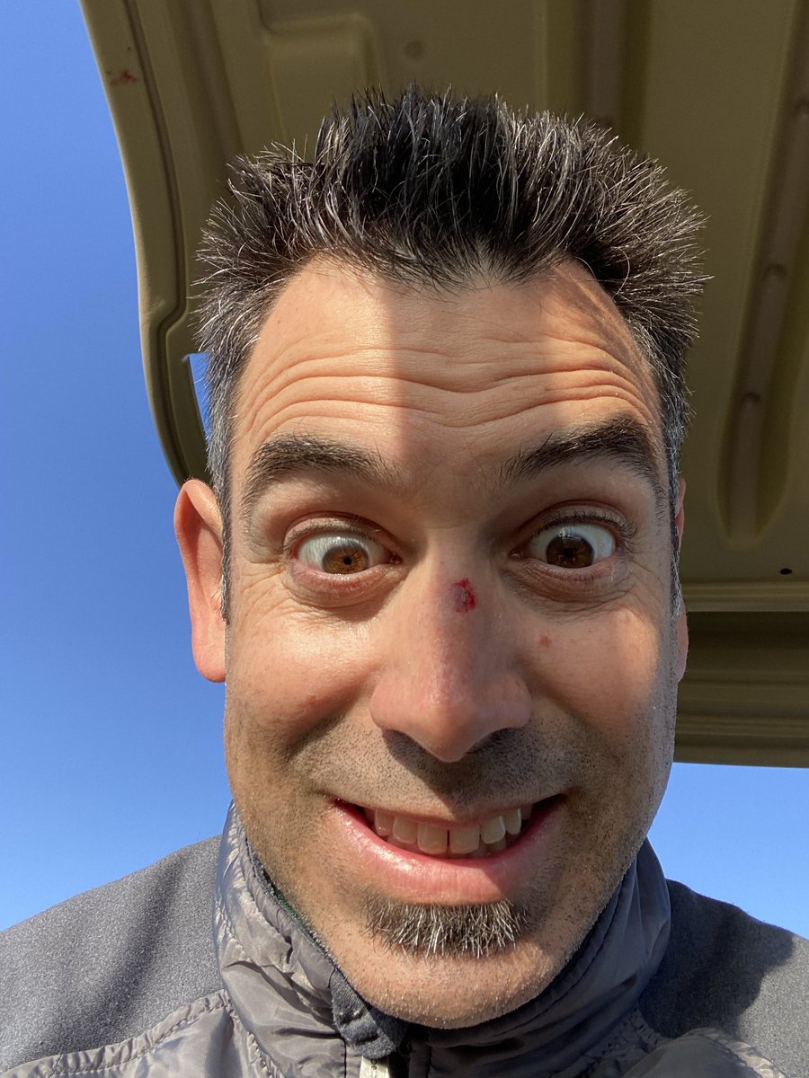 Trailteam08's tweet photo. @GlorifiedDonkey @ProZabbo @hoka Took one off the bridge of the nose last year.  Walked off the green sat in the cart and next thing I know... ball to the face. Guy was about 150 yards out and never said Fore. Drove up to him and asked him to yell fore next time. 🤦🏻‍♂️ https://t.co/dekGoyT9KB