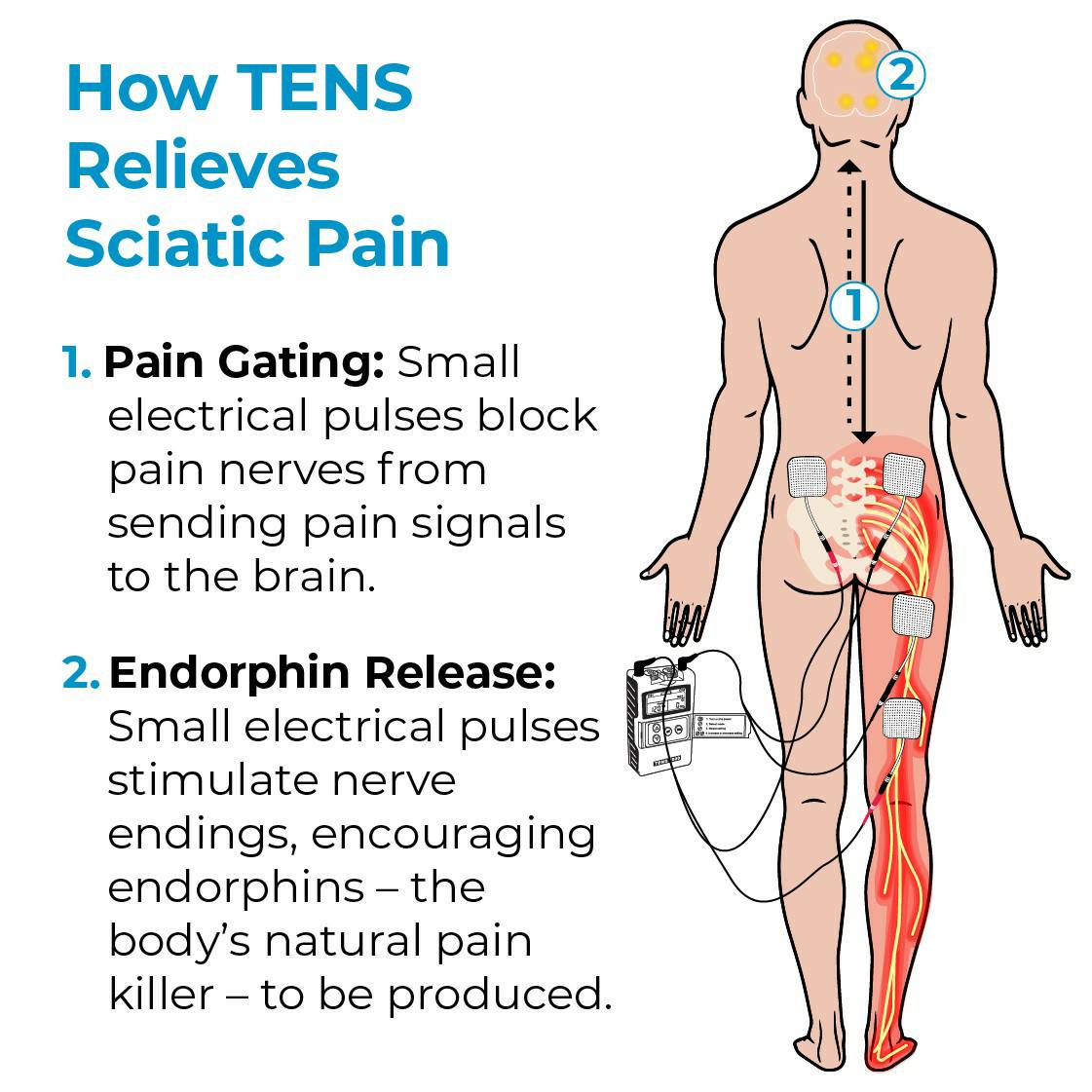 HayatHomeMed's tweet photo. Come pick up your Tens unit it's great for pain. And it's only $55. #hayathomemed #evergreenpark #equipment #tensunit #sciatica #pain https://t.co/Azni5NNzMf
