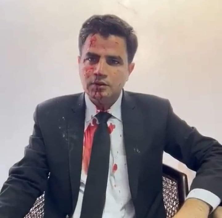 R50Ab's tweet photo. He was hit on the head and injured food. Lawyers were also beaten. Rangers dragged him into the car.
#نکلو_GHQ_کیطرف #نکلو_خان_کی_زندگی_بچاؤ https://t.co/ZKegIZH9w7