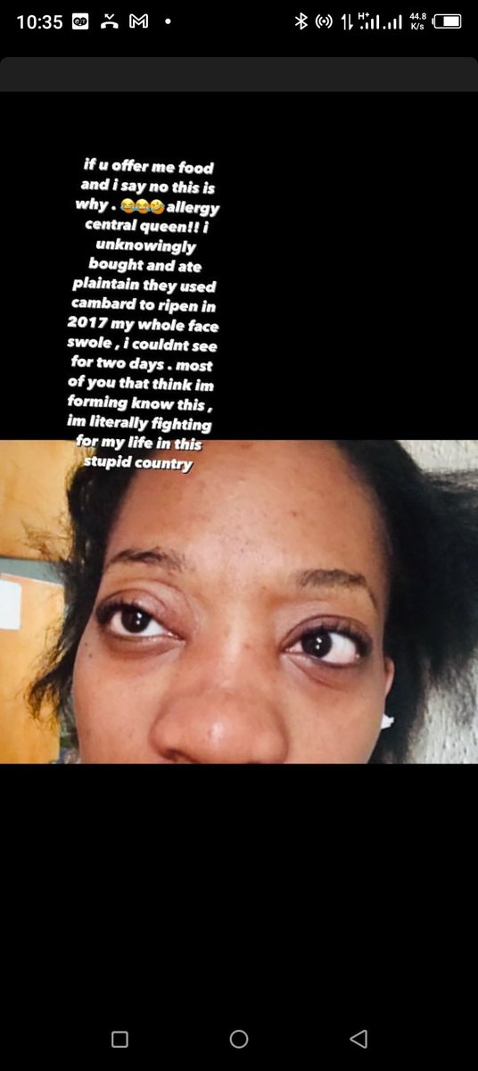 Bluntsuzzy's tweet photo. @lollypeezle So I am allergic to almost everything !! I am a living allergy princess . I also don't absorb glucose, galactose and maltose well, I have IBS and sinusitis.. but Nigerians think I'm forming when everyday is a battle for me , I have to watch what I eat , otherwise mans can just 💀 https://t.co/dbHpMwne4H