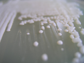 Some of the strains screened for conversion of short-chain fatty acids to microbial oils can grow at 25 g/L SCFAs. How cool is that?
#ERAnet <a href="/ERA_CoBioTech/">ERA CoBioTech</a> <a href="/oleoferm/">Oleoferm ERA CoBioTech</a> #Biotechnology