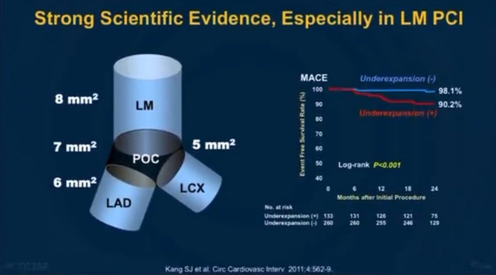 Zill_cardio's tweet image. #TCTAP2023 
@summitmd_cvrf

💥OCT 🆚️ IVUS: When, How, Why ⁉️

👉 When Is #IVUS Better ⤵️

#ImageFirst #IVUSvsOCT #CardioTwitter