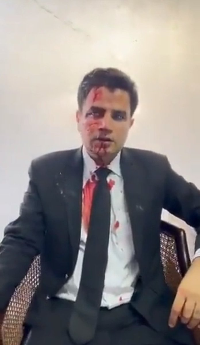 FtPTI's tweet photo. Imran Khan's lawyers and security personnel were tortured by the goons of the fascist government.
#BehindYouSkipperAlways  #عمران_خان_ہماری_ریڈ_لائن , #امن_کا_سفیر_عمران_خان 
 #پاک_فوج_ہماری_ریڈ_لائن #عمران_خان_کی_جان_کو_خطرہ #ImranKhan
#وقت_نہیں_گھر_رُکنے_کا https://t.co/MUb4h7Aqp8