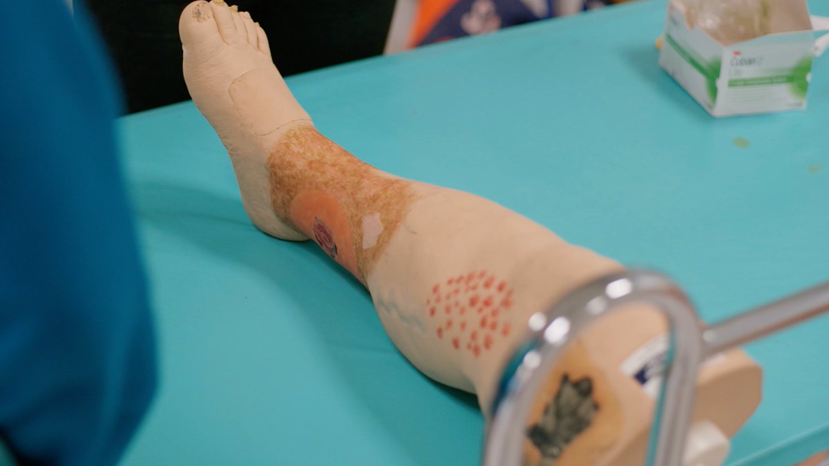University of GalwayARIW (@ariw_1) on Twitter photo Learn with the experts: our module on Advanced Wound Care Management starts Sept '23. To apply universityofgalway.ie/medicine-nursi… for info contact <a href="/georginagethin1/">georginagethin</a> <a href="/DrDuyguSezgin1/">Dr Duygu Sezgin</a> Learn with the experts: our module on Advanced Wound Care Management starts Sept '23. To apply universityofgalway.ie/medicine-nursi… for info contact <a href="/georginagethin1/">georginagethin</a> <a href="/DrDuyguSezgin1/">Dr Duygu Sezgin</a>