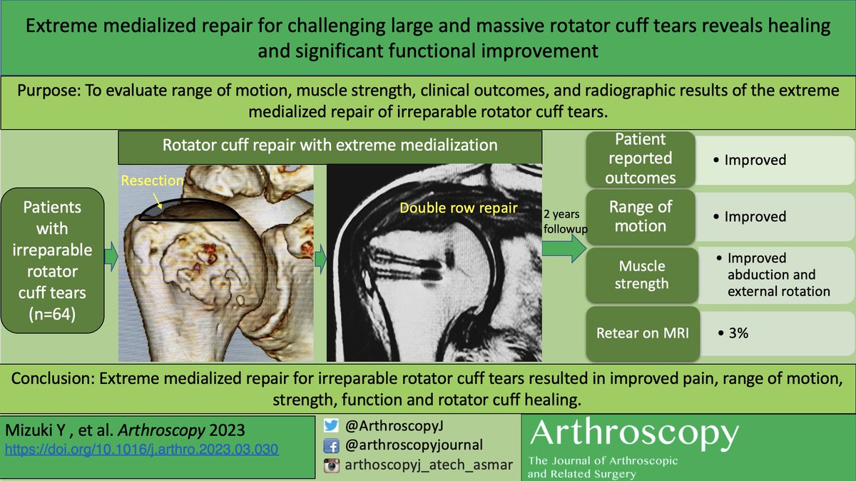 ArthroscopyJ's tweet photo. Extreme medialized repair for challenging large and massive rotator cuff tears reveals healing and significant functional improvement.” https://t.co/hnqpCVZqes https://t.co/tF66K2gtEB