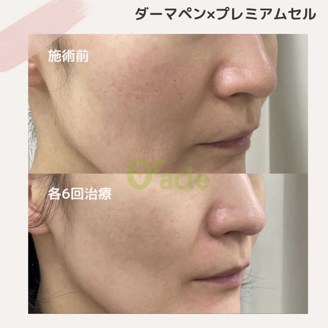 オラクル美容皮膚科【公式】 on X