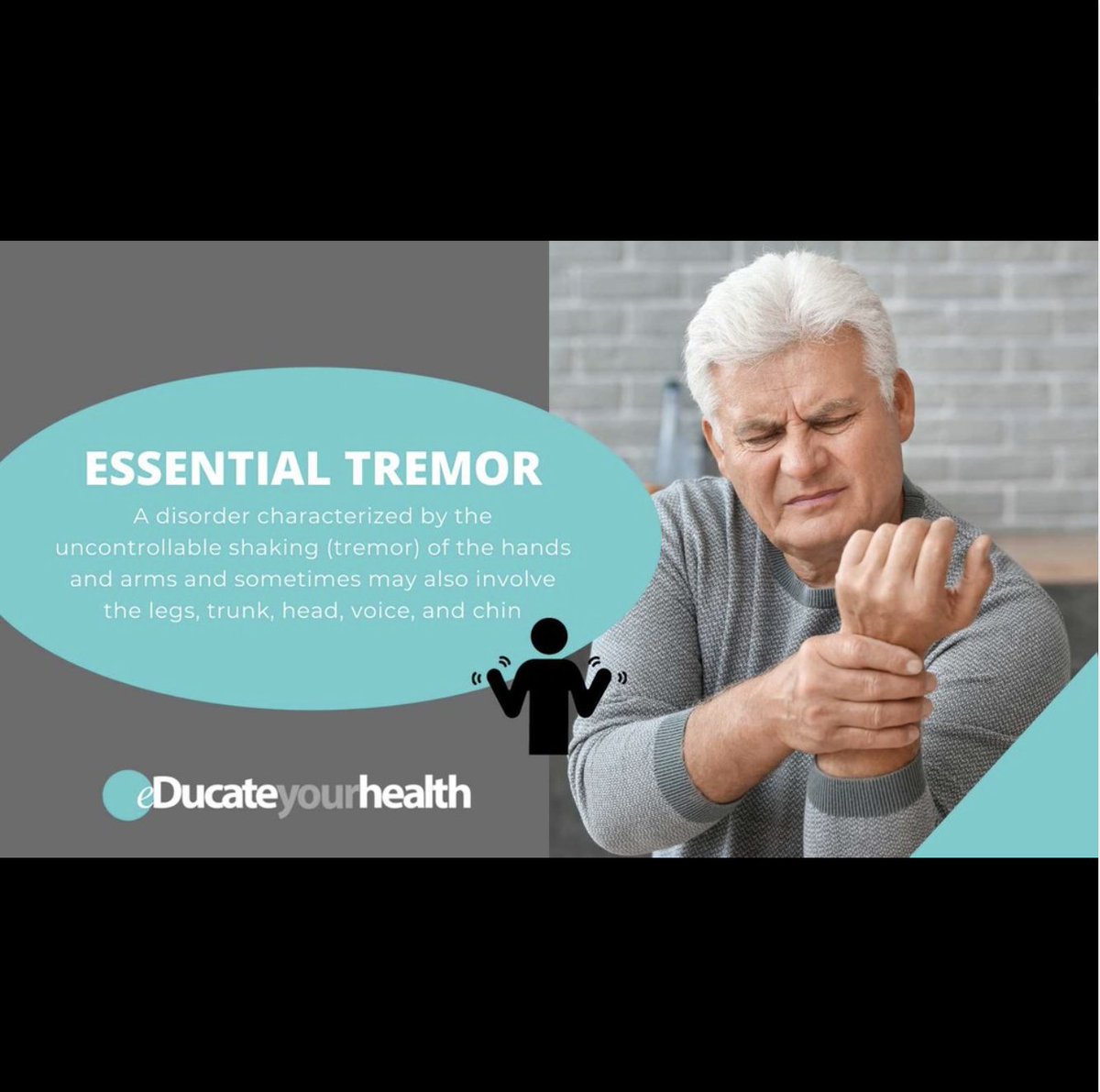 Did you know that essential tremor is the most common of all movement disorders. The condition is usually progressive and hereditary. To learn more about it go to our website:

educateyourhealth.com/patients/essen…

#educate #stayhealthy #staysafe #essentialtremor