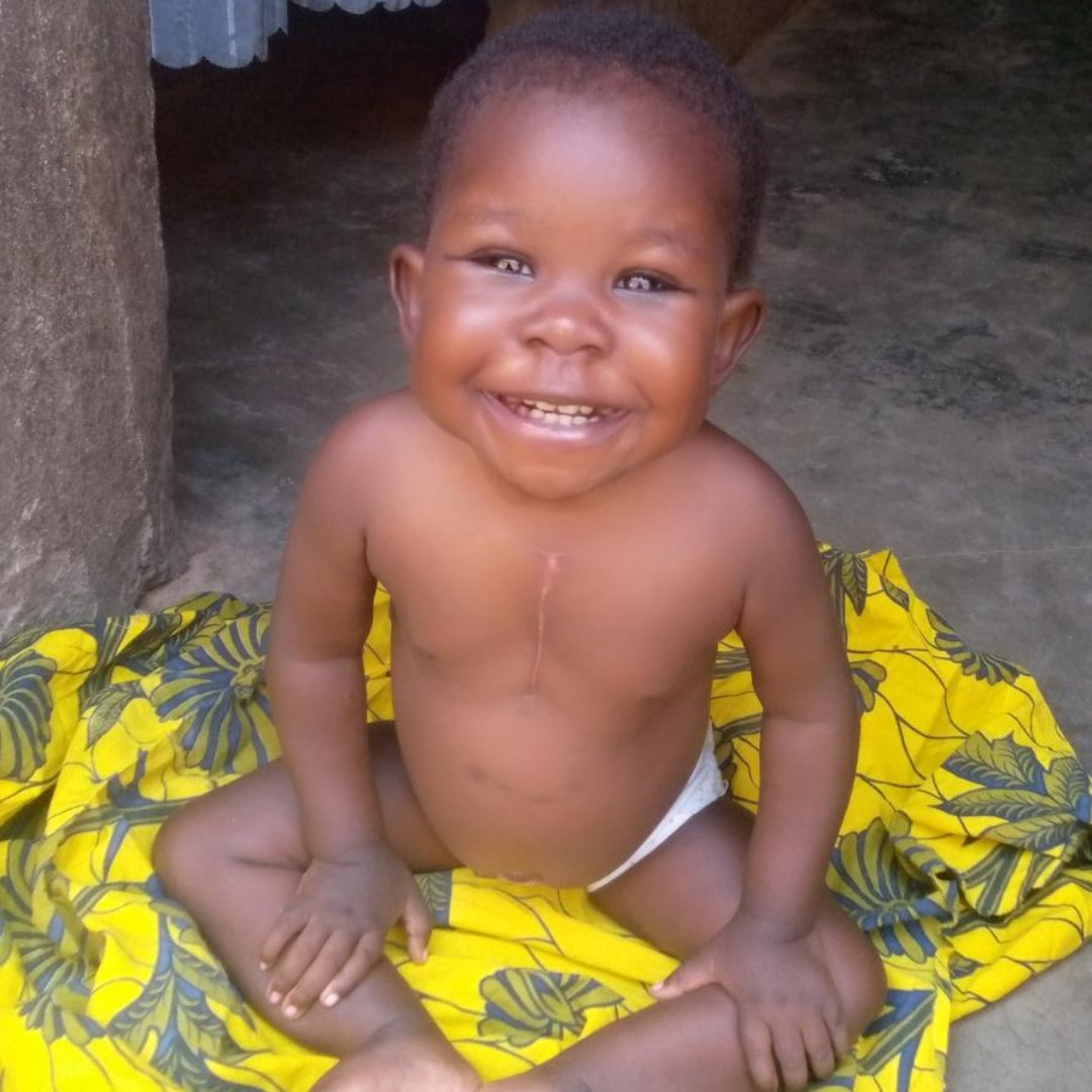 chainedelespoir's tweet photo. 💖 On vous donne des nouvelles d’Hanifa ! De retour au #Bénin, la petite fille âgée de 20 mois et opérée du cœur au @CHUBordeaux affiche un magnifique #sourire, des yeux pétillants et une cicatrice, synonyme d’#espoir et de vie. Nous te souhaitons le meilleur Hanifa 💖 https://t.co/MZzck3zpzb
