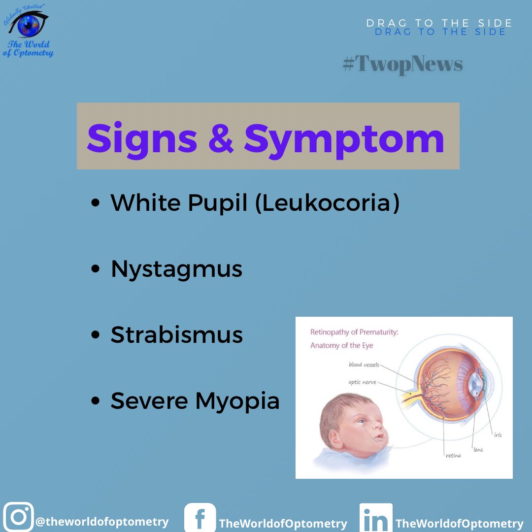 TWOPOFFICIAL's tweet photo. RETINOPATHY OF PREMATURITY (ROP)!

TWOP News brought to you by The World of Optometry, Globally United 🌎.

#TWOP #TheWorldofOptometry #Optometry #Optometrists #EyeCarePractitioners #OptometryStudents #EyeDoctors #EyeCare #VisualHealth #HealthyLife #Protectyoureyes #TwopMemes https://t.co/FtWAxBB5F1