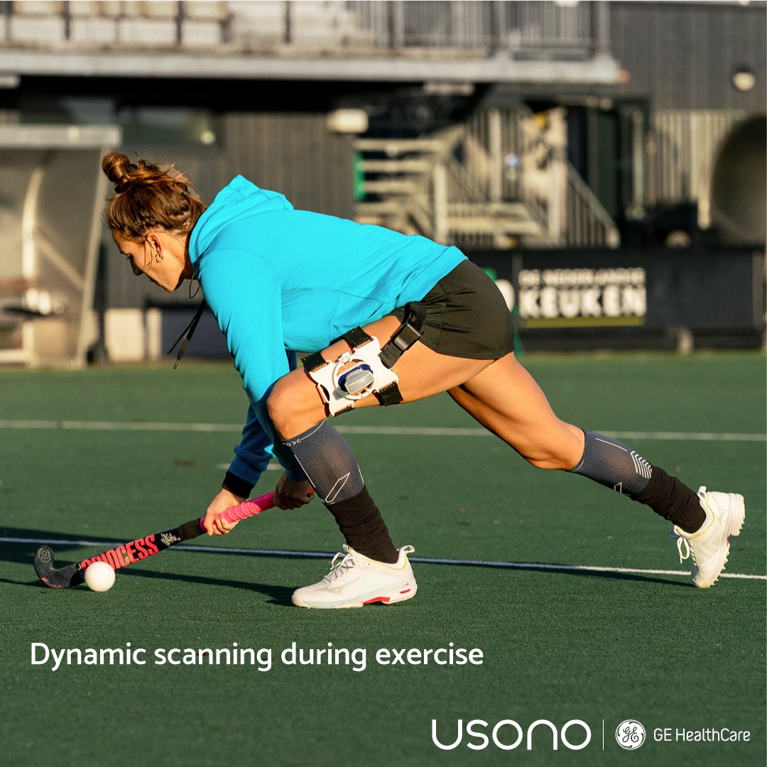usono's tweet photo. Together with @GEHealthCare we're changing the game: @vscan with ProbeFix Dynamic for live scanning of muscles in motion, directly on the pitch! #dynamicscanning #gehealthcareultrasound #sportsmedicine #vscanair #usono #probefix #musclesinmotion #rethinkultrasound https://t.co/zLCoKAPRth