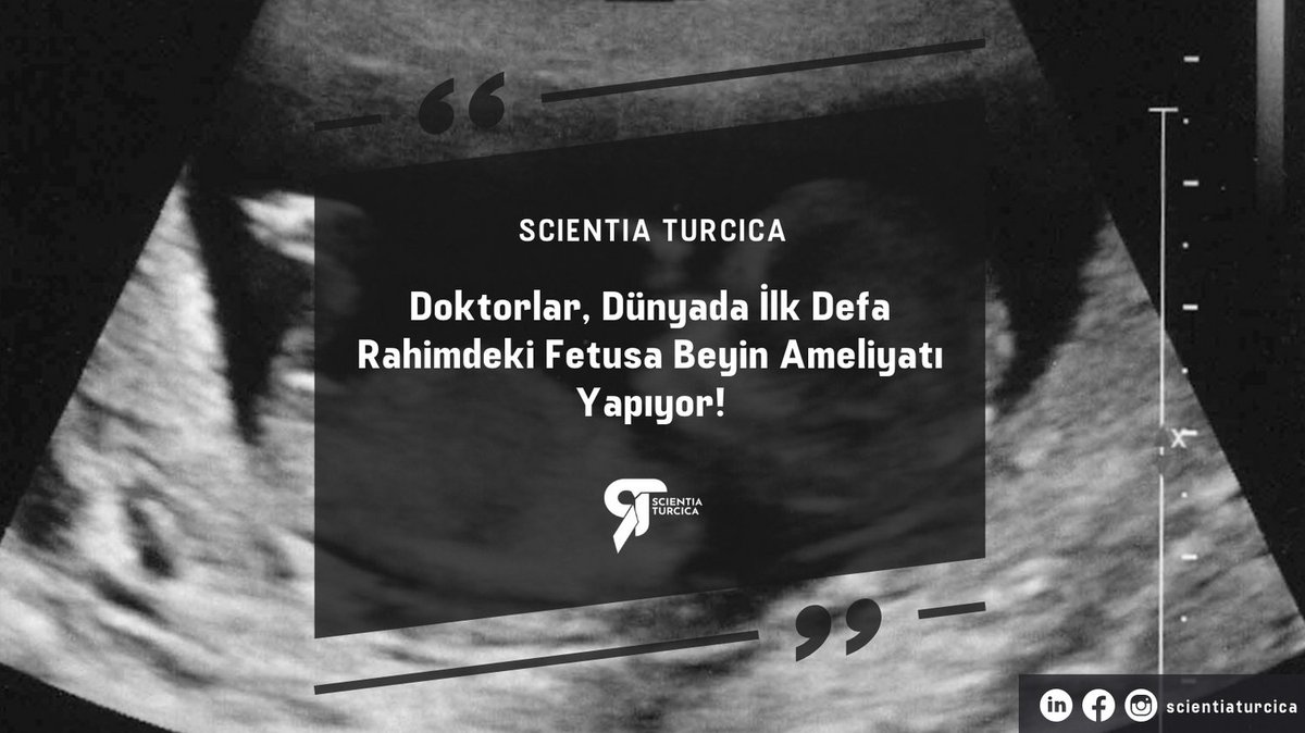 ScientiaTurcica's tweet photo. Cerrahlar ilk kez bir fetüsün beynindeki büyük bir malformasyonu başarıyla onardı.

#cerrah #fetus #doktor #sağlık

https://t.co/kISwfJeioY https://t.co/5Rgskb2gn7