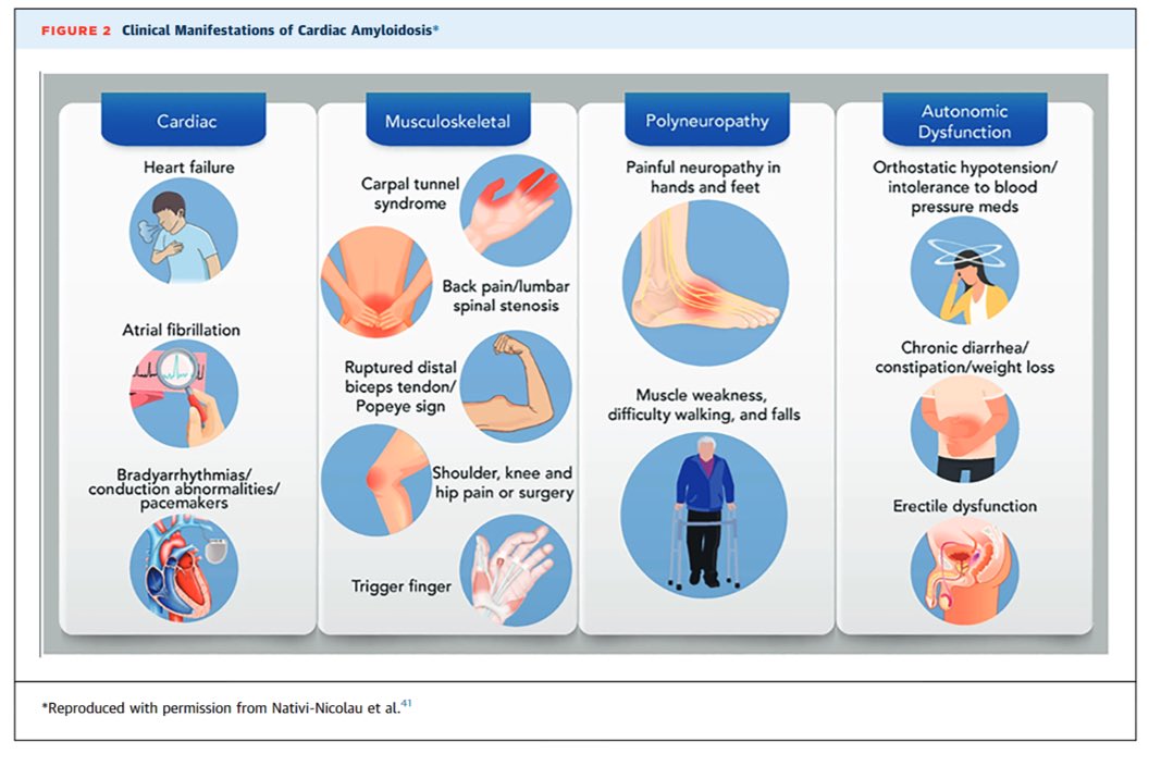 dr_algburi's tweet photo. Clinical manifestations of cardiac amyloidosis. 
#CardioEd #MedEd #CardioTwitter #MedTwitter #FOAMed https://t.co/pQGnzxL3UQ