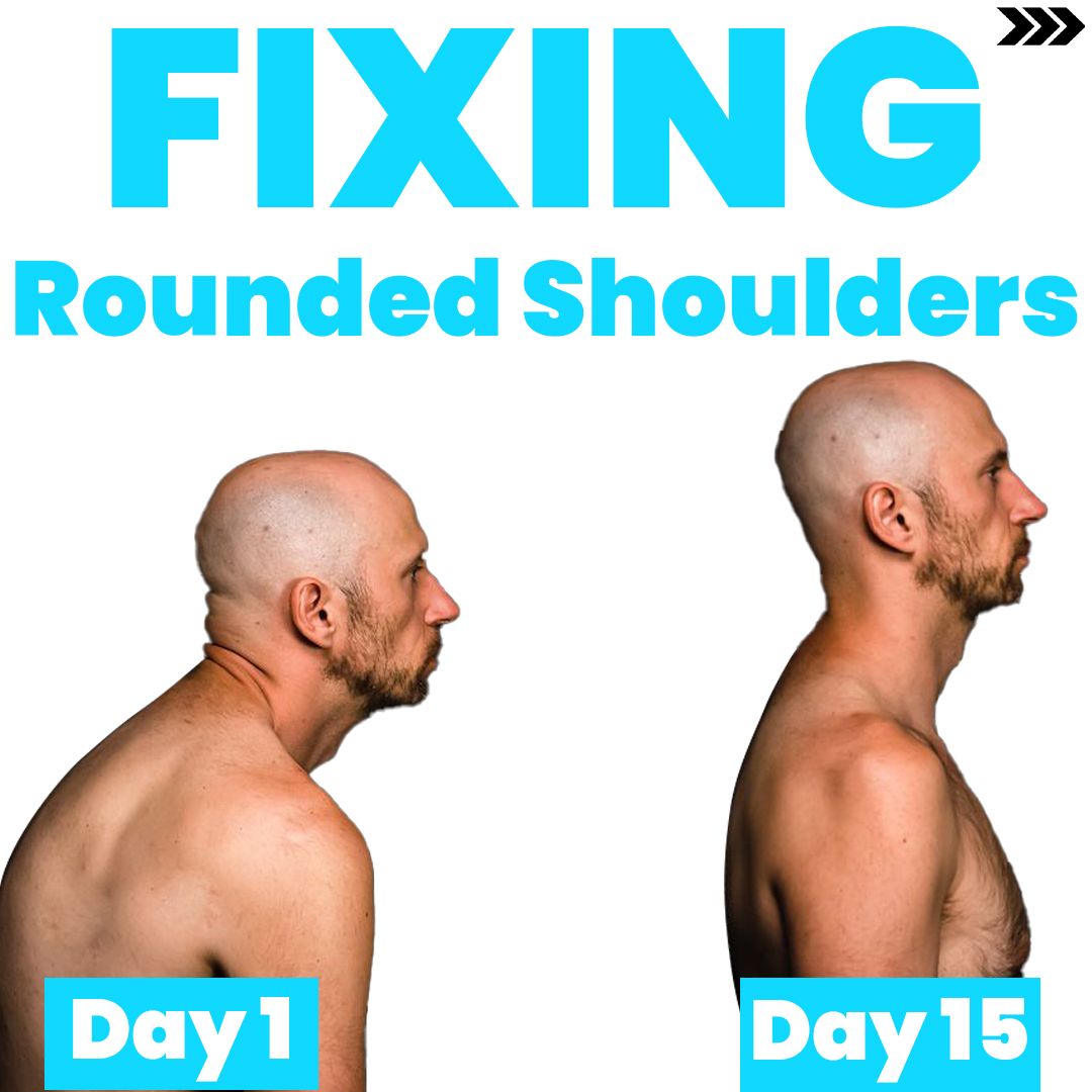 Zac Cupples on X: To fix rounded shoulders, should we simply stand up  straight & pull our shoulders back allthetime? NO! That's because  that does NOT address the biggest contributor to rounded
