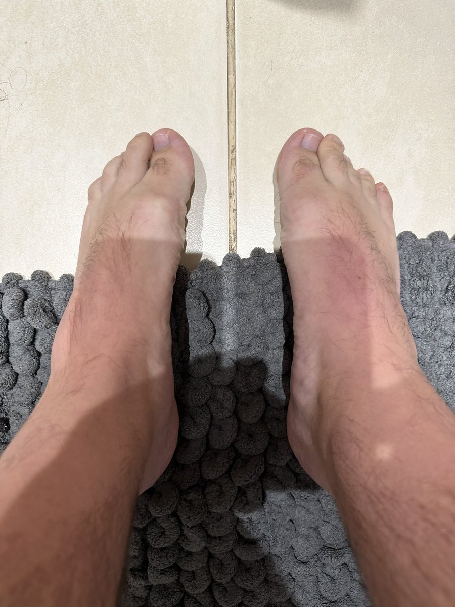 fookin_joke's tweet photo. @Thetoesfinder_1 Fresh toes https://t.co/z3eKzZ1fnw
