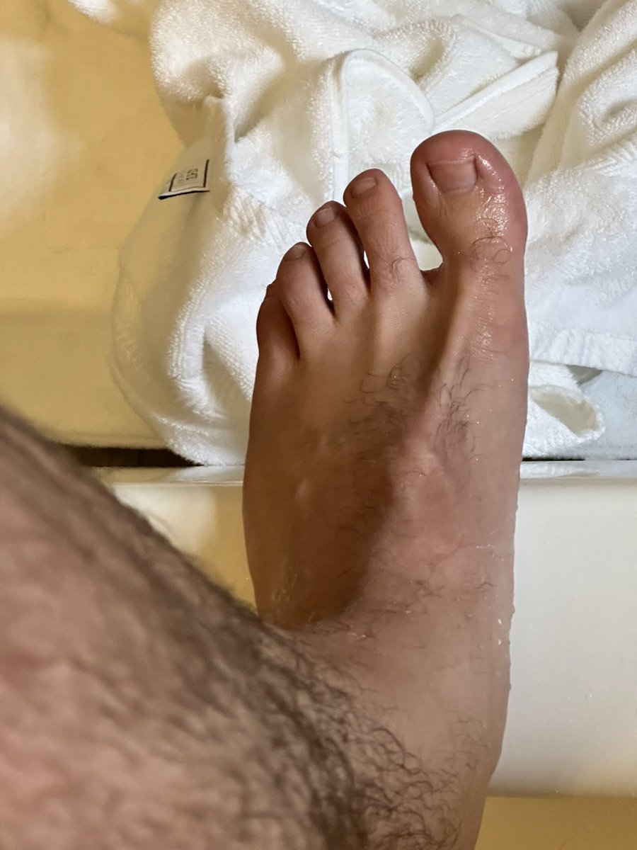 fookin_joke's tweet photo. @Thetoesfinder_1 Fresh toes https://t.co/z3eKzZ1fnw