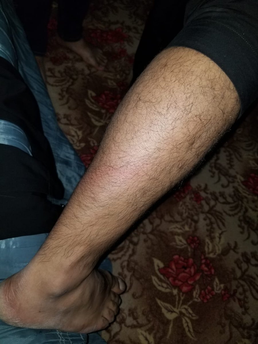 SdqJaan's tweet photo. کچھ ہی دیر پہلے پولیس نے شمس آباد راولپنڈی میں پی ٹی آئی رہنما راجہ محفوظ کے ڈیرے پر چھاپہ مارا ہے،
اس دوران ہمارے 2 صحافی دوست سید مستجاب حسن اور فیضان اشرف جو باہر سے گزر رہے تھے، انہوں نے جب موبائل پر ویڈیو بنائی تو پولیس اہلکاروں نے شدید تشدد کا نشانہ بنایا.
نہ تو یہ پہلا واقعہ ہے اور نہ آخری،
ظلم ابھی مزید بڑھے گا.