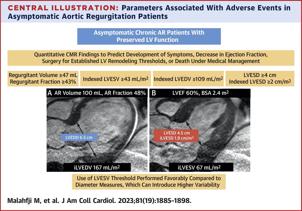 Q: What is the association of cardiac magnetic resonance quantitative thresholds and outcomes in patients with aortic regurgitation?

A: The authors report that in asymptomatic AR patients with preserved LVEF, CMR findings can be used to guide management. bit.ly/41ohEQC