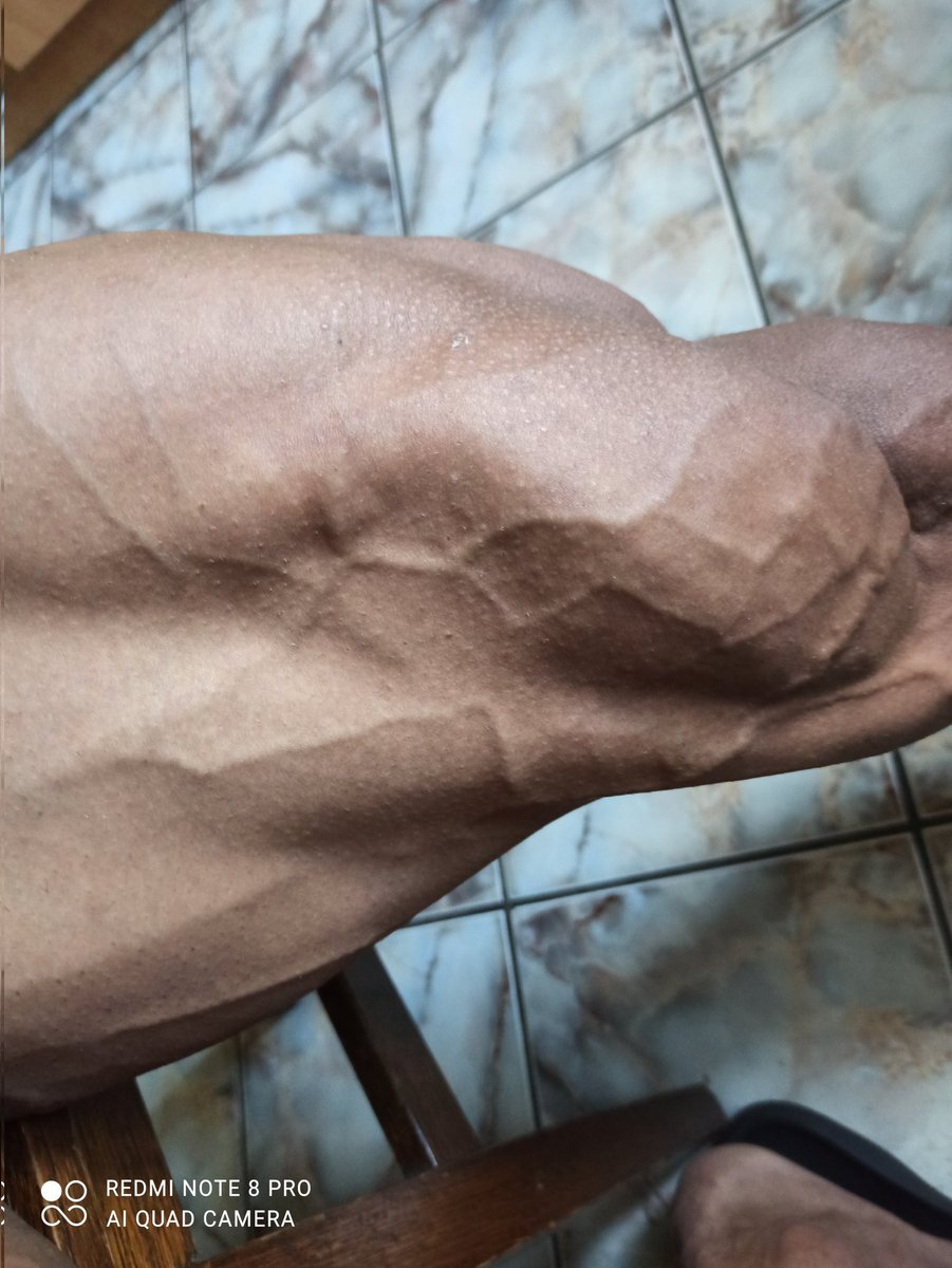 PetrescuMag's tweet image. #Leg #Vascularization