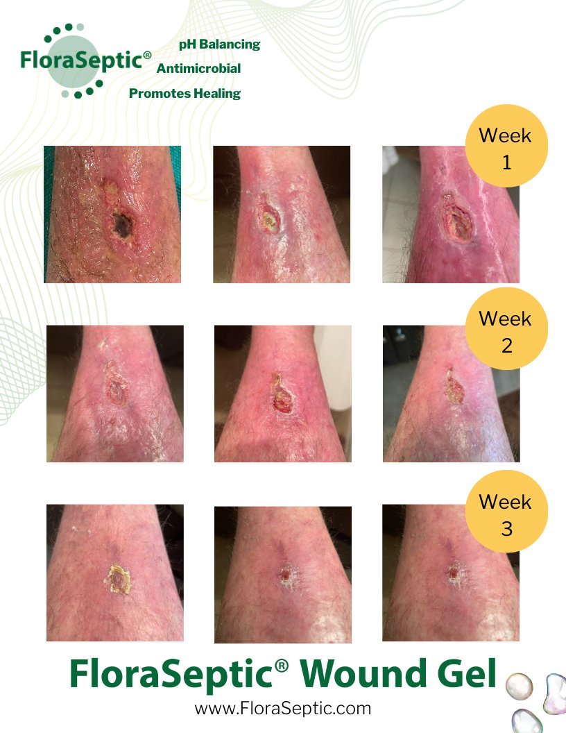 Got Wounds? Get FloraSeptic! 

#promotehealing #floraseptic #woundcare