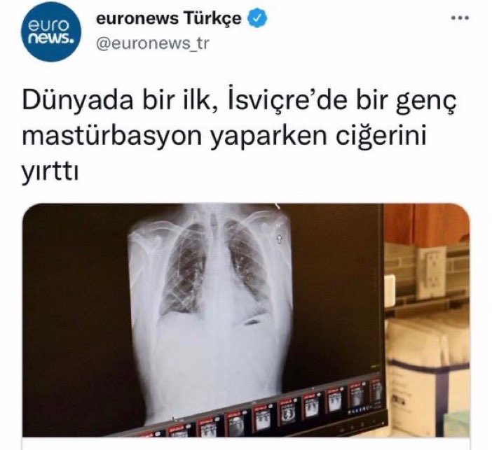 absürt olaylar tweet media