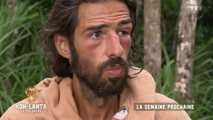 Ruzteiger's tweet photo. Il sait pas que c'est Clémence qui l'a tabassé pendant qu'il dormait #KohLanta https://t.co/BgS77DaQ0f