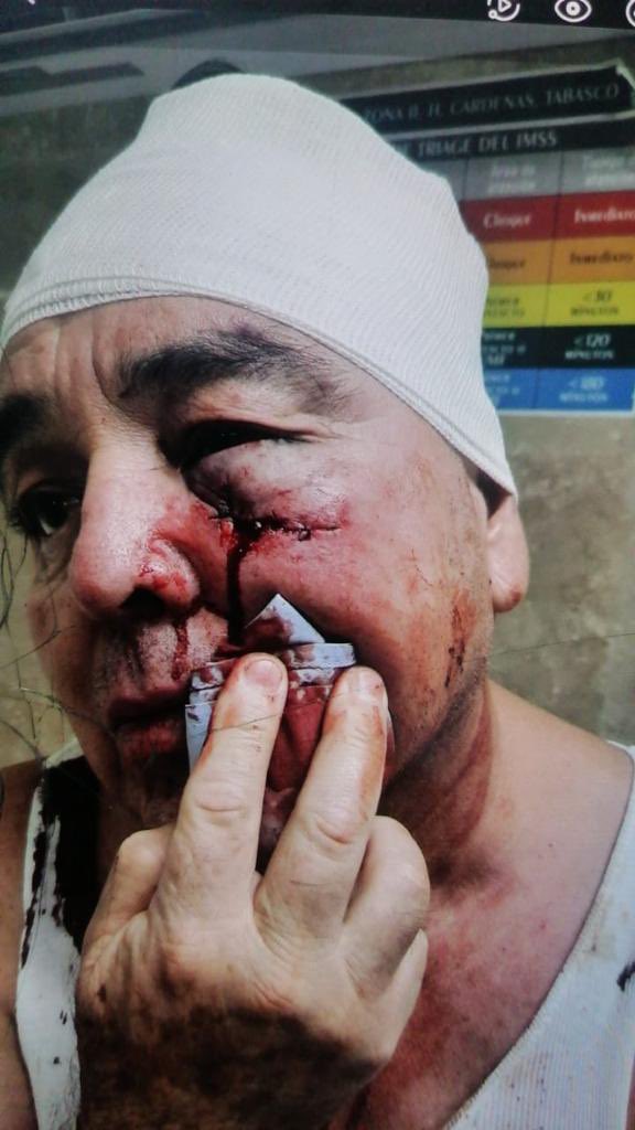 azucenau's tweet photo. Estudiante del plantel 35 del Colegio de Bachilleres, ubicado en Cárdenas, Tabasco,  se encuentra retenido en la Fiscalía del estado tras agredir con un martillo a su profesor por haberlo reprobado en la materia de historia. https://t.co/ys7QRcknV7