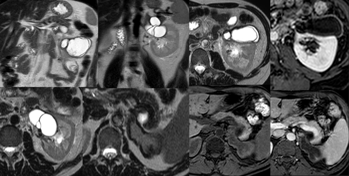 Ramon Coronil tweet media