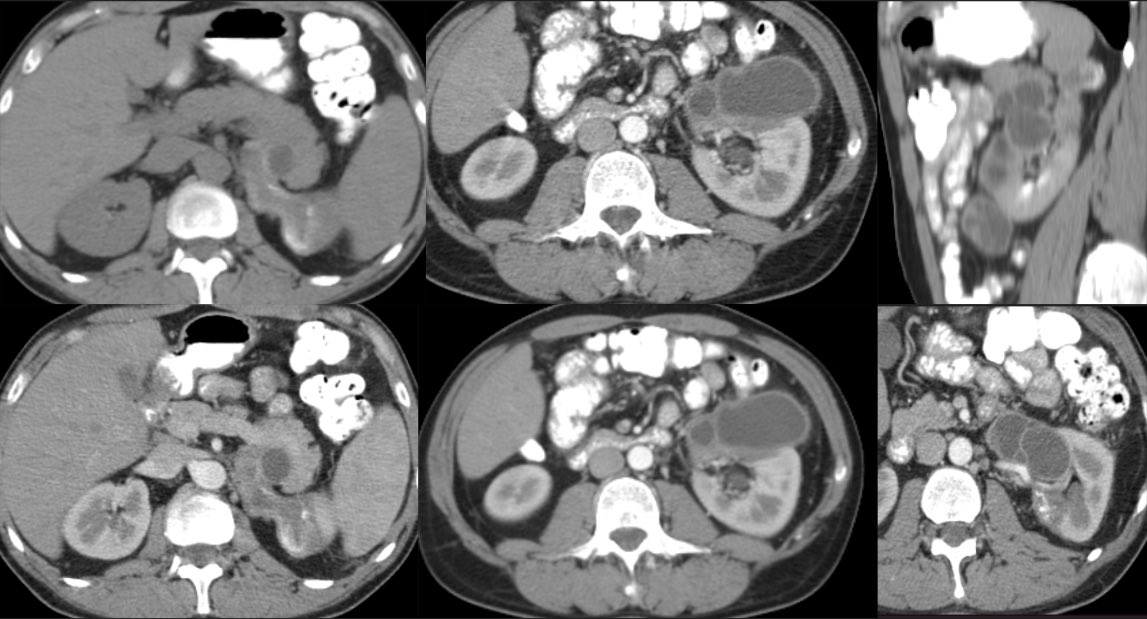 Ramon Coronil tweet media