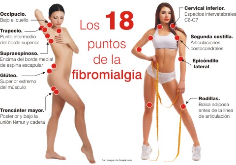 GloriaMargaCapr's tweet photo. Estos son lo 18 puntos musculares del dolor en #fibromialgia. Si hay suerte pueden doler dos o tres a la vez, no siempre los mismos. En el peor de los casos pueden dolerte los 18, eso hace que esta enfermedad sea muy cruel y discapacitante.
#12DeMayoLaFibromialgiaExiste https://t.co/1HUPNWMh5V
