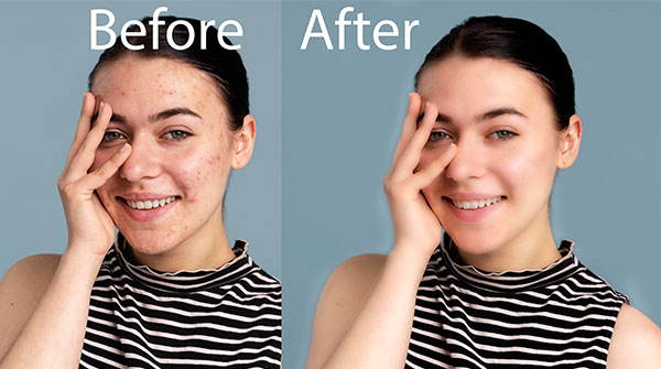 rubeldesignr10's tweet image. #editing #editimage #faceclean #photoediting #imageresize I will give you the first image without any cost for the check.
Unlimited Revision with 15 images for 5$. 
DM me or email: rubeldesignr@gmail.com