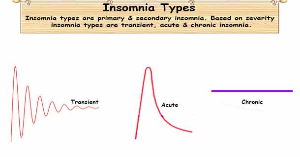 Insomnia Types buff.ly/3yJRugO #Insomnia #InsomniaTypes #Sleep #SleepDisorders #SleepProblems #SleepDeprivation