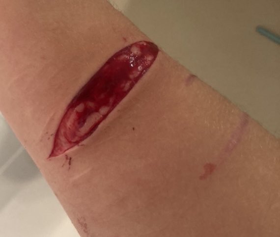 cutmeopeen's tweet photo. a few pictures &amp; a video from the beginning and end of tn it’s so small I hate it so much I’m so sad I couldn’t get to finish it https://t.co/pptZ6Nf1ag