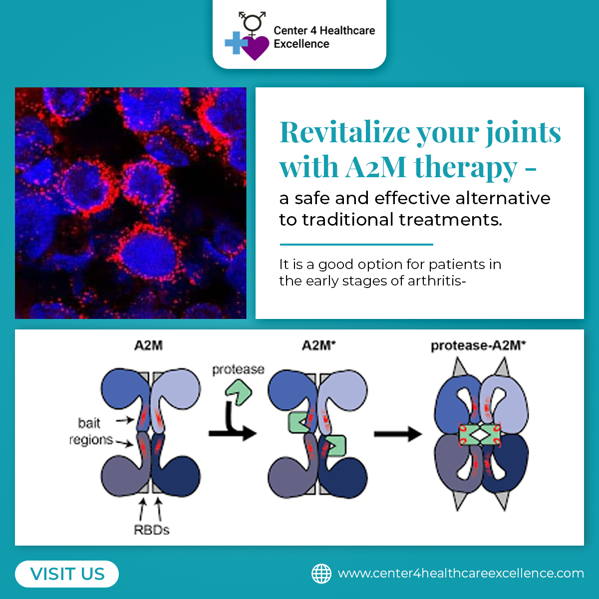 HealthCenter365's tweet photo. Revitalize your joints with A2M therapy - a safe and effective alternative to traditional treatments.

It is a good option for patients in the early stages of arthritis-
https://t.co/odbduS1jg2

#A2Mtherapy #jointpainrelief #regenerativemedicine #arthritis #wisconsin https://t.co/JoAoGfVlJH