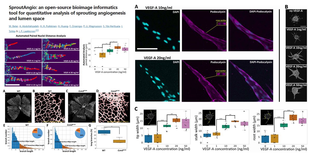 HaoYin20's tweet photo. SproutAngio
A Python pipeline to quantify vascularization & #Lumenogenesis🤠
Fibrin beads spouting assay
Mouse retina #Angiogenesis
Code👇
https://t.co/p8EIN6y7d4
Dr. Johanna Laakkonen lab @SciReports 2023 @GroupLaakkonen
https://t.co/kKmW9MUF5T https://t.co/iM6aIFudaj