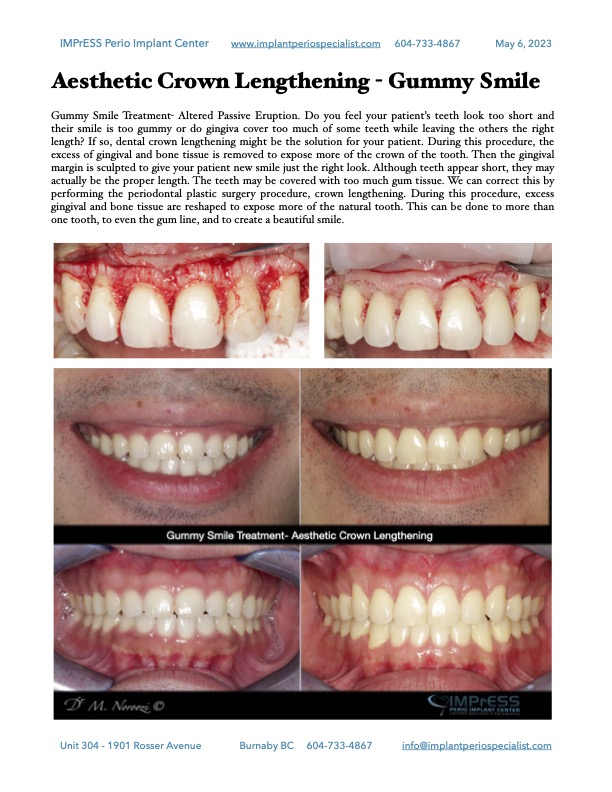 impressperio's tweet photo. Our newsletter is here. Call us to get your free copy. #DentalImplants #EducationForAll #dentistry https://t.co/LX91tfx10A