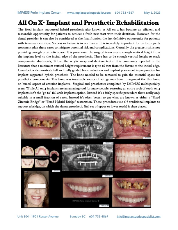 impressperio's tweet photo. Our newsletter is here. Call us to get your free copy. #DentalImplants #EducationForAll #dentistry https://t.co/LX91tfx10A