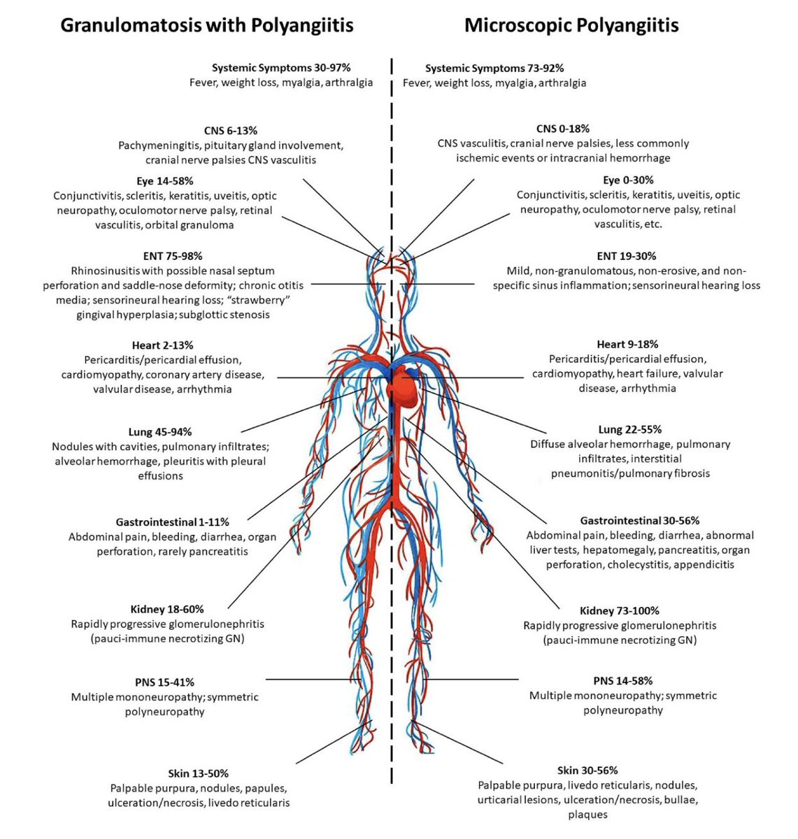 ERheumat's tweet photo. 🆕👌Diagnosing and treating ANCA-associated vasculitis: an updated review for clinical practice
ANCA-associated vasculitides (AAV) are a group of rare, primary, systemic necrotizing small-vessel vasculitides.
🔗: https://t.co/IuhgAaNZsV https://t.co/ytEQOP8nec